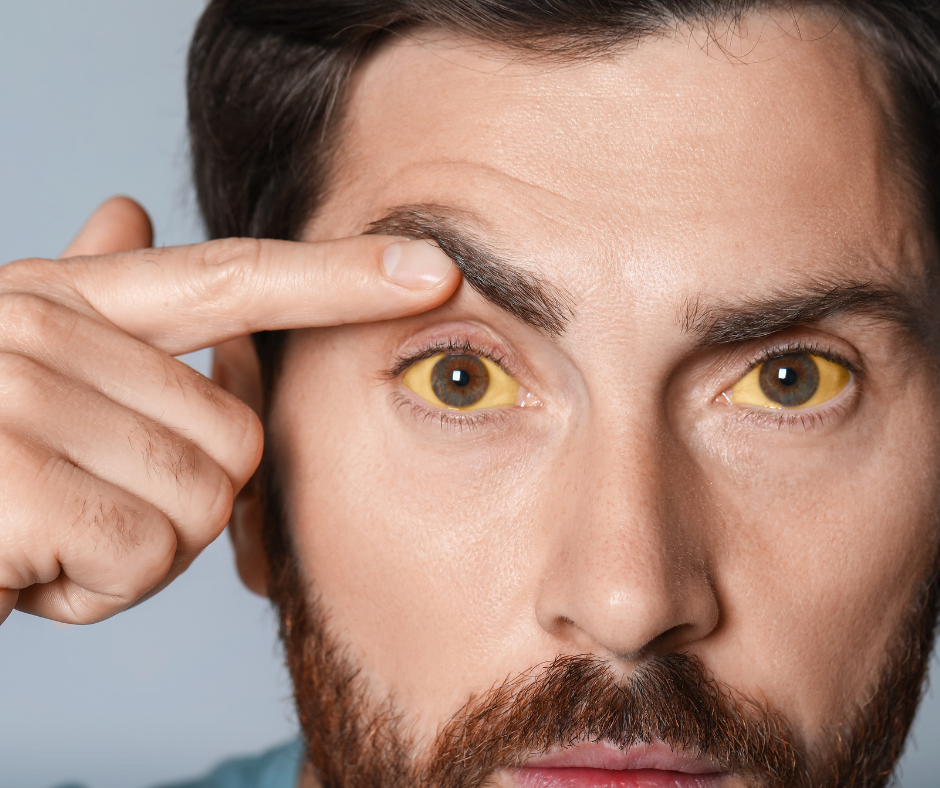 Potřebuji přeočkovat proti žloutenkám typu A a B